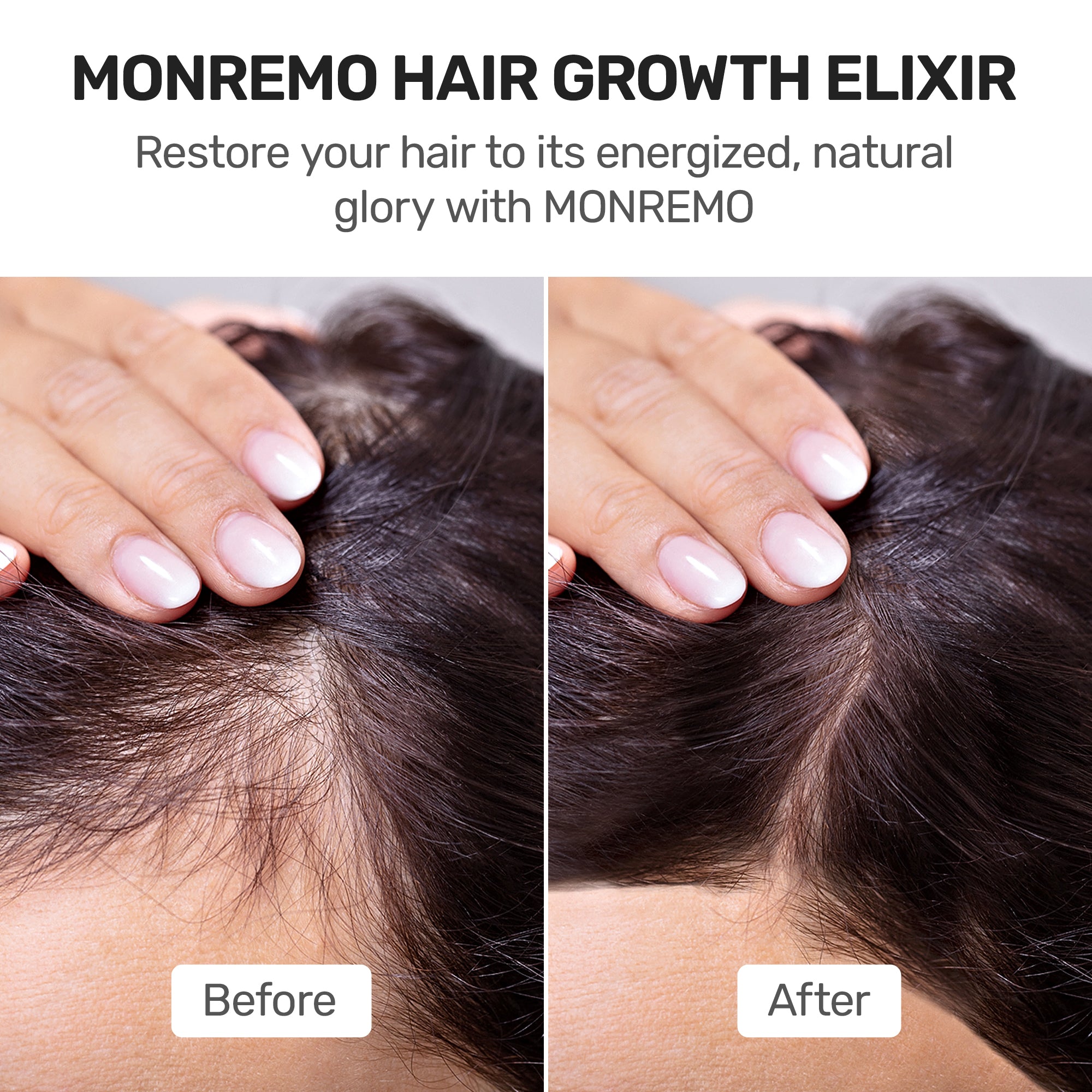 MONREMO Hair Growth Elixir with Turmeric, Caffeine & Biotin